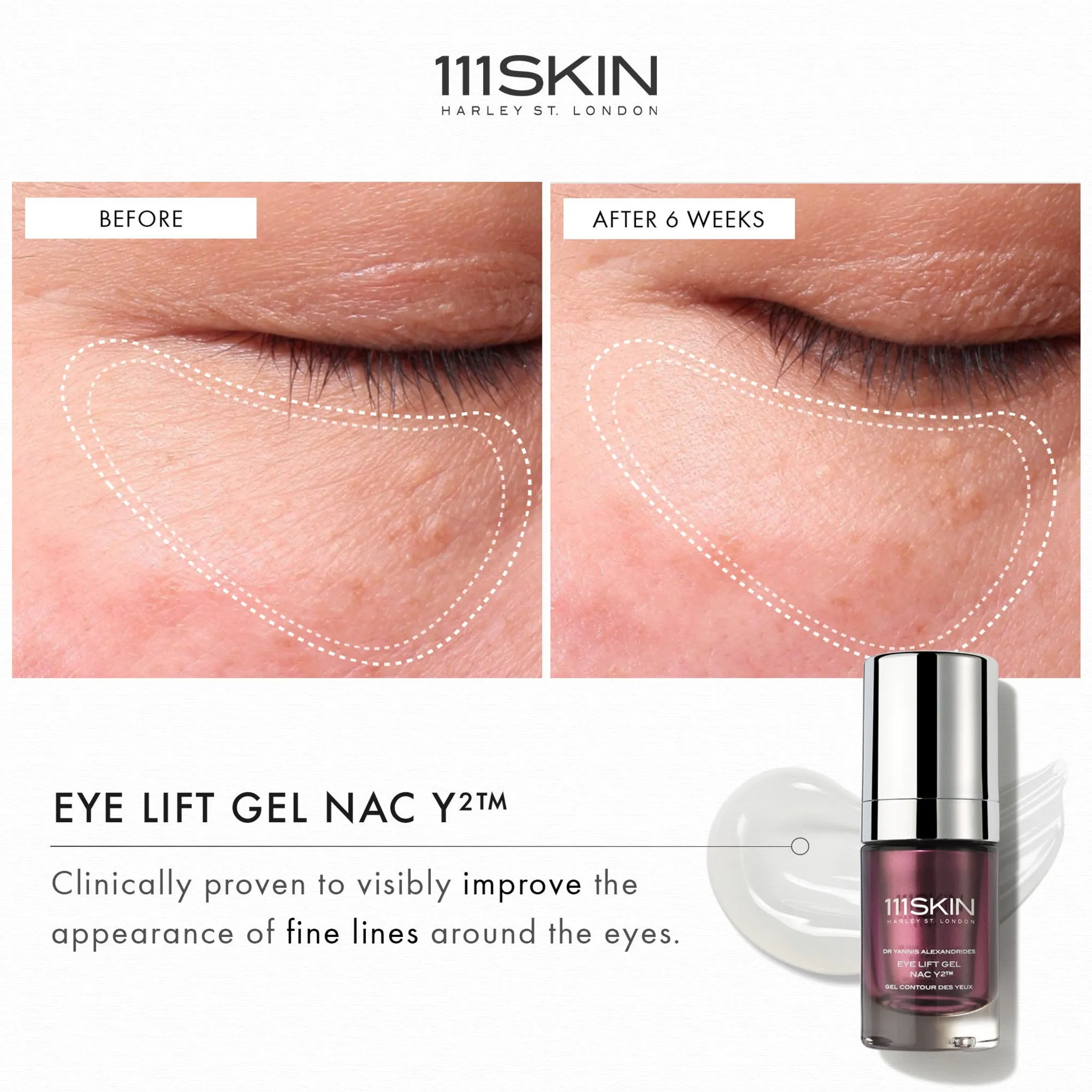 Eye Lift Gel NAC Y2